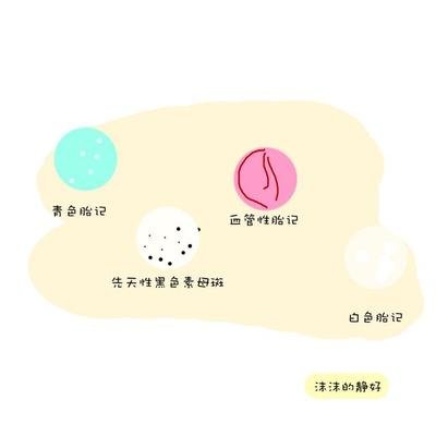 佛说胎记缘由宝宝有胎记的孩子，附胎记图片大全详解